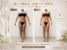 エステティックサロン サロン ド ヴィーナス 新宿店/お腹スッキリ