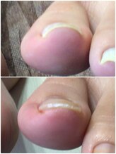 モアクリスタル(More Crystal)/