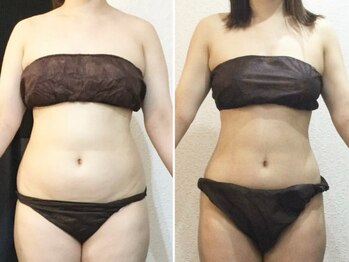 美容整体 ウェリナ 蟹江院/小顔矯正/骨盤矯正/美脚サロン