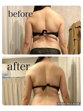 リープ(Lieb)/ボディビフォーアフター