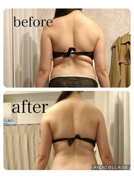 リープ(Lieb)/ボディビフォーアフター