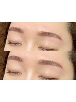 顔脱毛がしたい