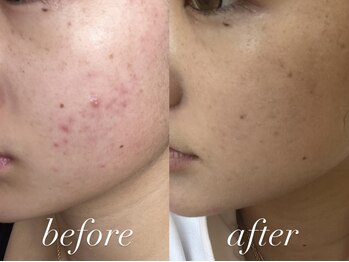 ミランサ ギンザ(MIRANSA GINZA)/【B/A】マーメイドセルと化粧品