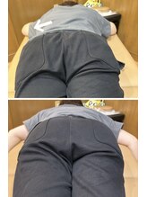 リノ25(LINO25)/骨盤矯正はとても大事！