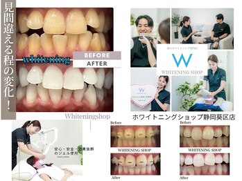 ホワイトニングショップ 葵区静岡駅店/ホワイトニング店ホワイトニング
