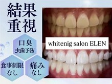 エレン 高槻店(ELEN)/結果重視☆ホワイトニング
