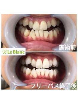 ルブラン 奈良店(Le Blanc)/通い放題頑張って頂きました！