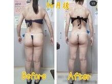 ラファ(Rapha)/40代3ヶ月後