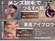 トレースの写真