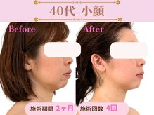 アファン 鶴見店(Afun)
