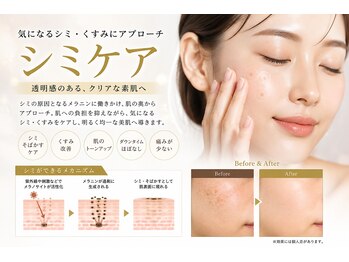 ユティル(Utile)の写真/【30・40代の肌悩みに】気になるシミをピンポイント集中ケア！素肌に自信が持てる透明美肌へ♪
