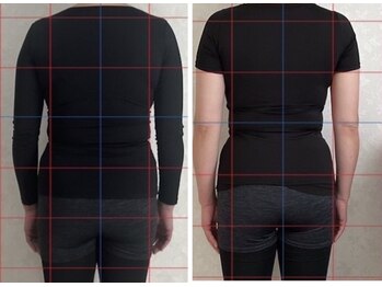 猫の目/骨盤・猫背矯正　8回目終了結果