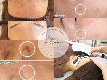 ベルフィーヌ(belfine)の写真