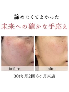 キラリ(kirari)/素敵なお客様のご紹介｜シミケア