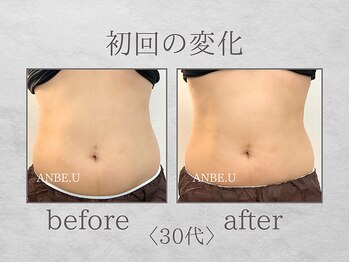 アンビーユー(ANBE.U)/腸もみビフォーアフター