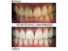 ホワイトニングショップ 妙高店(whiteningshop)の雰囲気（ホワイトニング専門サロンで理想の白い歯！笑顔に自信！！）