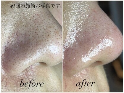 スパークルの写真