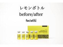 クリニカルエステ イーズ あべのキューズタウン店/イーズ全国で喜びの変化！！！