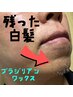 【ヒゲの白髪が気になる方に】残った白髪をブラジリアンワックスで綺麗に!