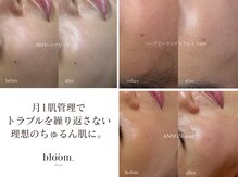 ブルーム(bloom.)