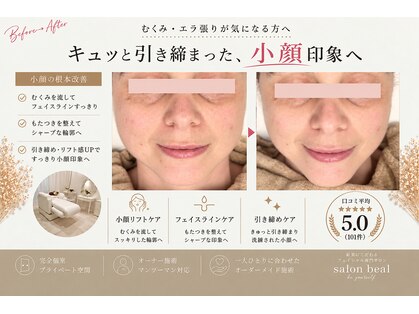 ベアール(beal)の写真