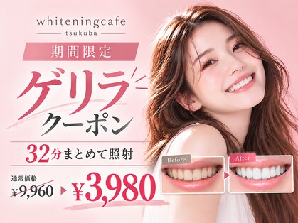 ホワイトニングカフェ つくば研究学園店の写真