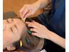 【３月限定】頭皮鍼40分オプション利用で割引！