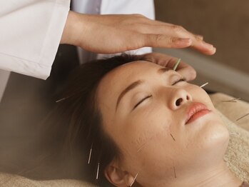 リュクス 恵比寿 代官山(LUXE)/施術風景【美容鍼/代官山/東京】