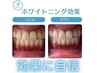 【ホワイトニング学割U24】☆セルフホワイトニング◇20分照射￥3800→￥1280
