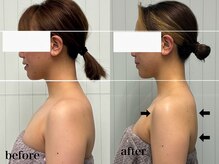 ベール(BEHL)/コルギのBefore After