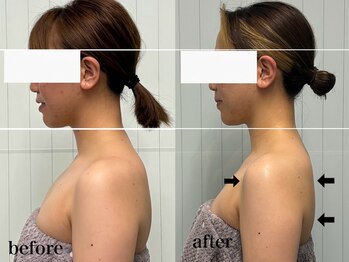 ベール(BEHL)/コルギのBefore After