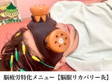 もみの木鍼灸整骨院 恵比寿/【既存様限定メニュー】脳洗浄鍼