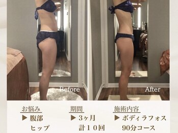 ベレガ 京都店(BELEGA)/◆beforeafter◆