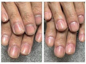 キララ(Kirara)/ネイルケア