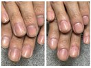 ネイルケア