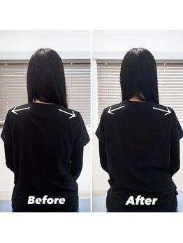 ジェイミープラス 表参道(J‘aimee +)/骨盤矯正ビフォーアフター