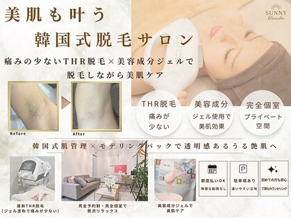 サニーブランシュ(SUNNY blanche)の写真