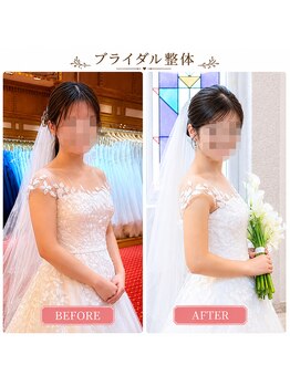 にしやま整骨院の写真/【ブライダル美容整体/美シルエット】骨格を整え、結婚式前に自分史上最高のボディを☆初回お試し￥5,980！