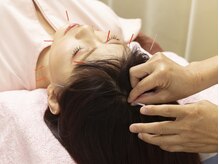 桂林堂鍼灸治療院 日吉/★頭痛にお悩みの方へ★