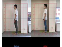 けいのき鍼灸整骨院/姿勢から身体を楽に!整体/肩こり