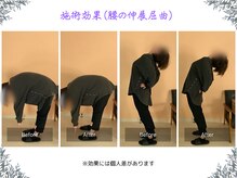 ボディ リセット アンド デザイン(Body Reset & Design)/【施術例】ビフォーアフター