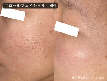 ジュパール(je pars)/プロセルセラピーズ