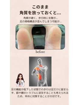 ヒューマン鍼灸接骨院/ 爪整体で美しさと健康を！