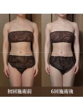 ルマ(Rumah)/首肩の盛り上がりもスッキリ