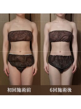 ルマ(Rumah)/首肩の盛り上がりもスッキリ