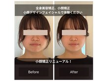 結果重視の小顔矯正。全身美容矯正でも体験できます！