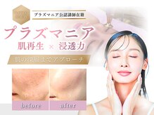 毛穴改善プラズマニア◎ニキビ肌を根本改善!角栓や黒ずみケア