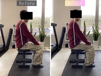 ウェルサス(WELLSUS)/ストレートネックの改善