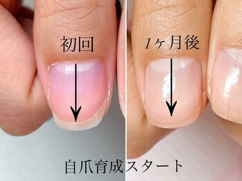 トゥインクリーネイルサロン(Twinkly Nail Salon)/【地爪育成】1回お試し