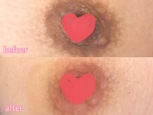 カシェット(cachette)/ローマピンク・ニップル